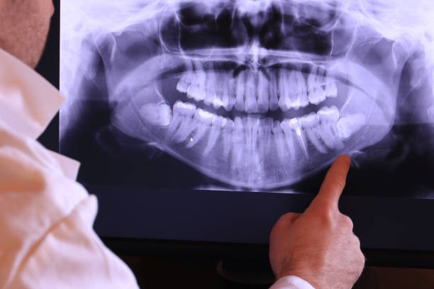 Best Cracked Tooth Emergency Dentist  in Stallings, NC
