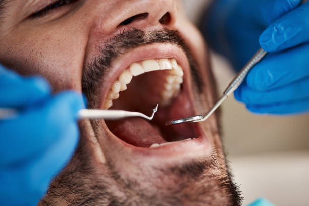 Best Tooth Infection Emergency Dentist  in Stallings, NC