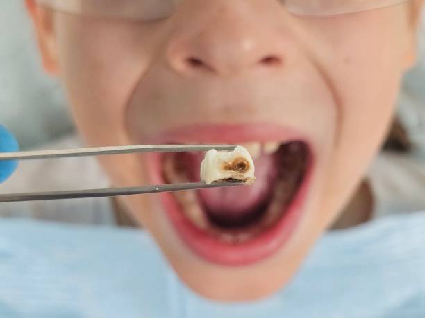 Best Tooth Pain Emergency Relief  in Stallings, NC