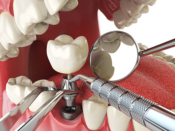 Best Urgent Tooth Repair  in Stallings, NC